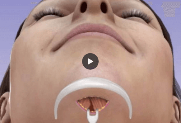 chin augmentation overview