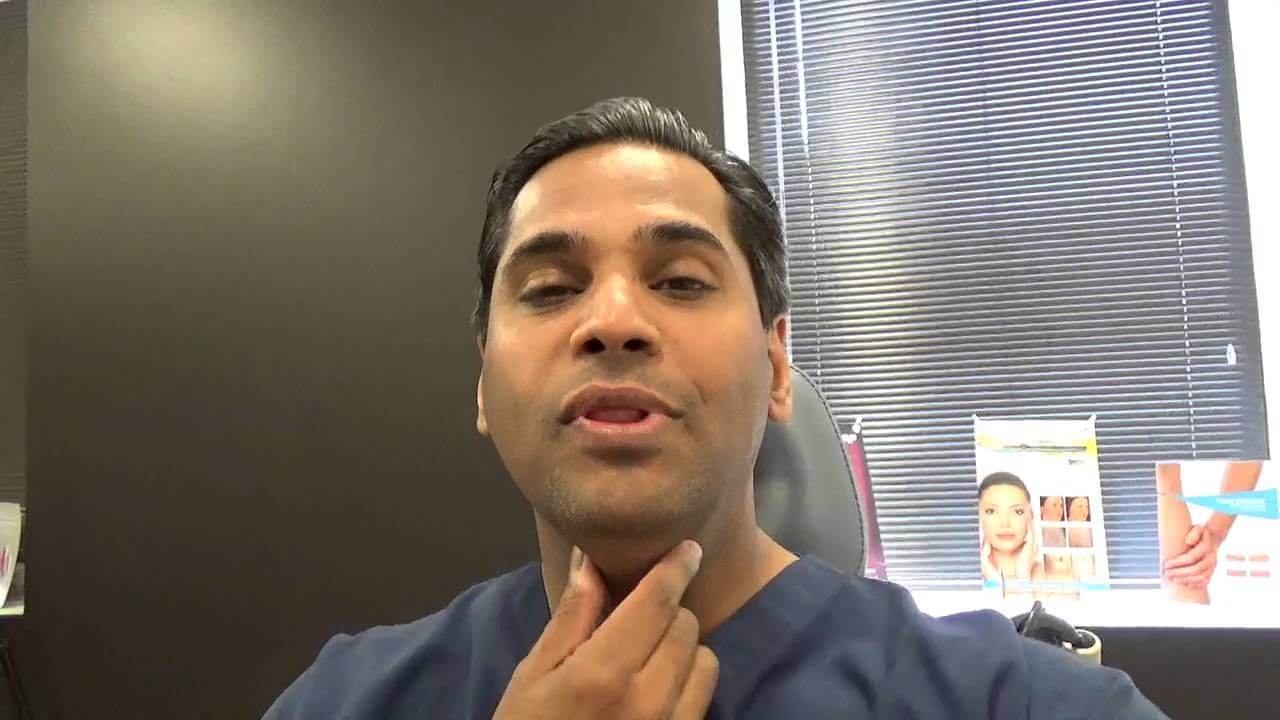 kybella day after result video