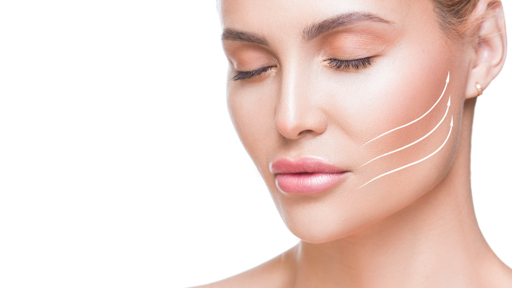 deep plane face lift benefits