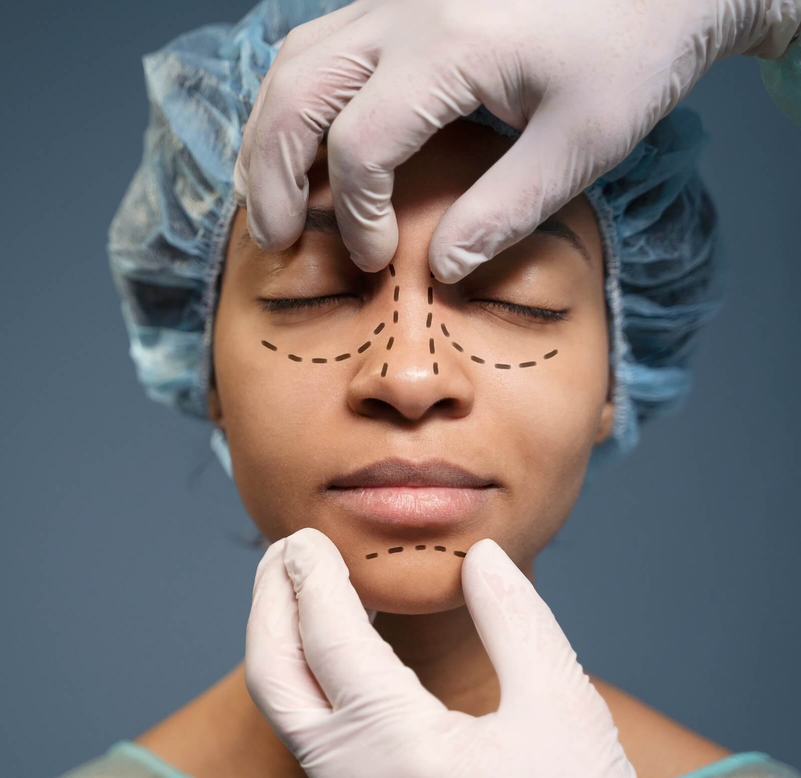 what is ultrasonic rhinoplasty