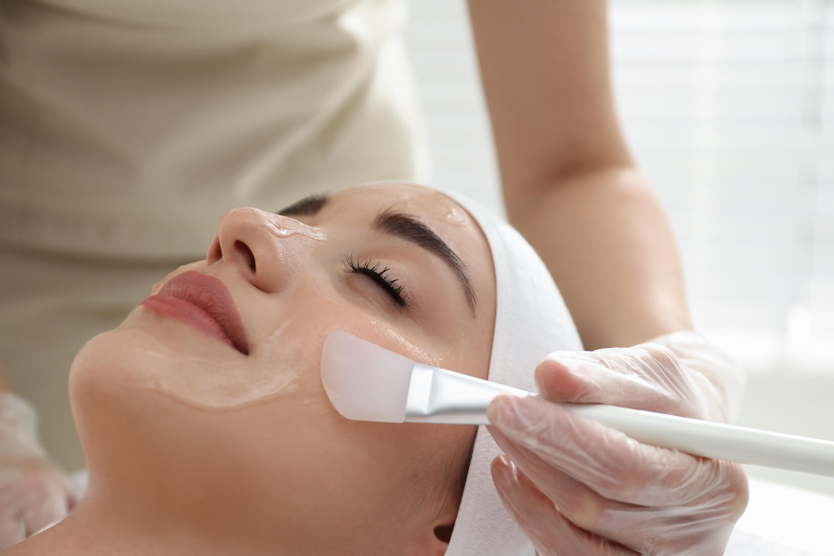 chemical peel help brown spots