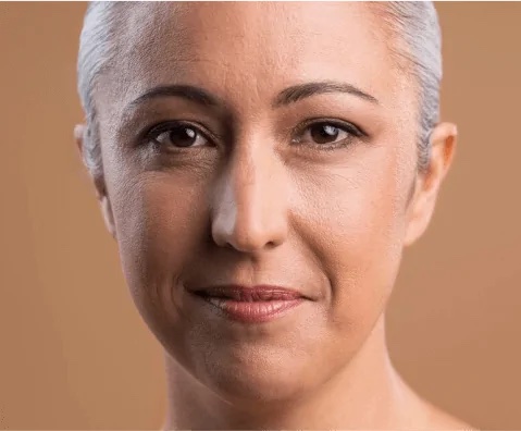 ethnic rhinoplasty