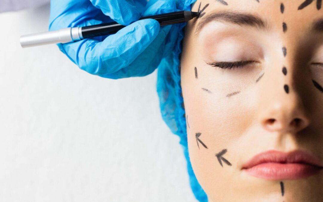 How Long Does A Deep Plane Facelift Take? Procedure Length And Recovery Timeline